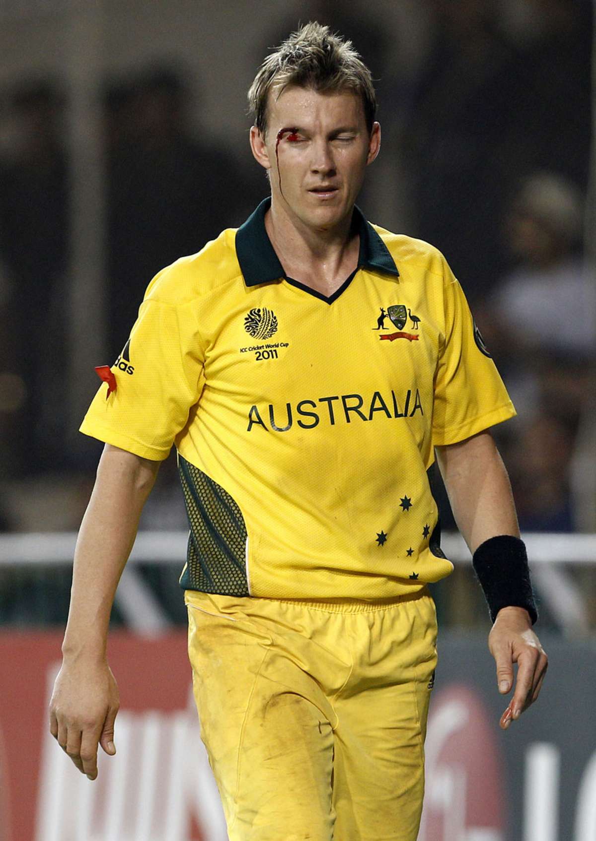 Brett Lee