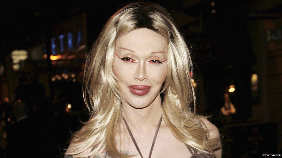 Pete Burns